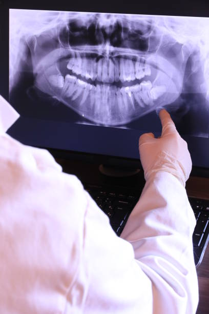 Best Emergency Tooth Extraction in Shenandoah Junction, WV