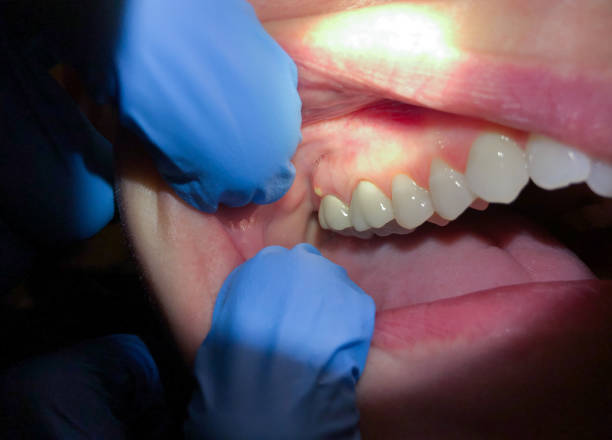 Best After-Hours Emergency Dentist in Shenandoah Junction, WV